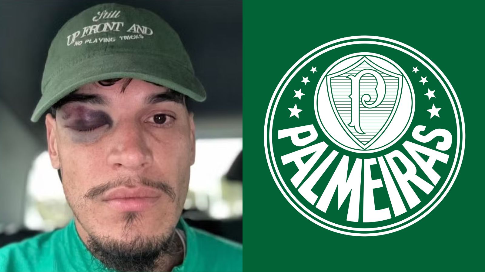 Palmeiras: Gómez mostra olho roxo após e Abel recebe notícia preocupante
